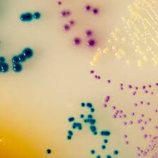 CHROMOGENIC UTI AGAR - 5