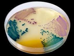 CHROMOGENIC UTI AGAR - 3
