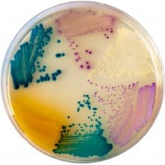 CHROMOGENIC UTI AGAR - 4