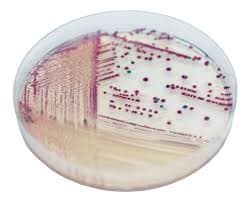 CHROMOGENIC VIBRIO AGAR - 3