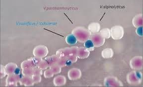 CHROMOGENIC VIBRIO AGAR - 5